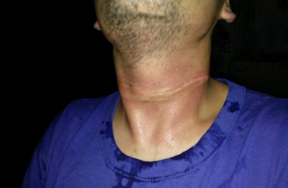 Venía circulando en su moto y casi terminó estrangulado por un cable