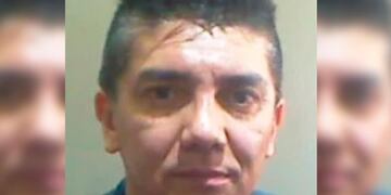 Cirujano acusado de violar a su pareja\u002E