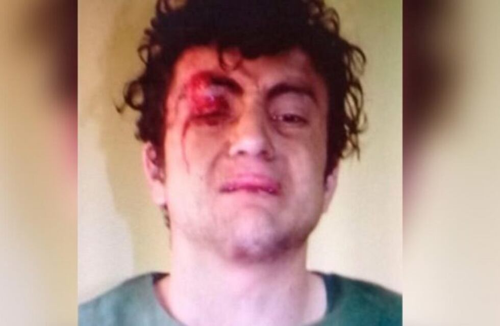 Un joven mató a su mamá, hirió a su abuela y agredió a un policía