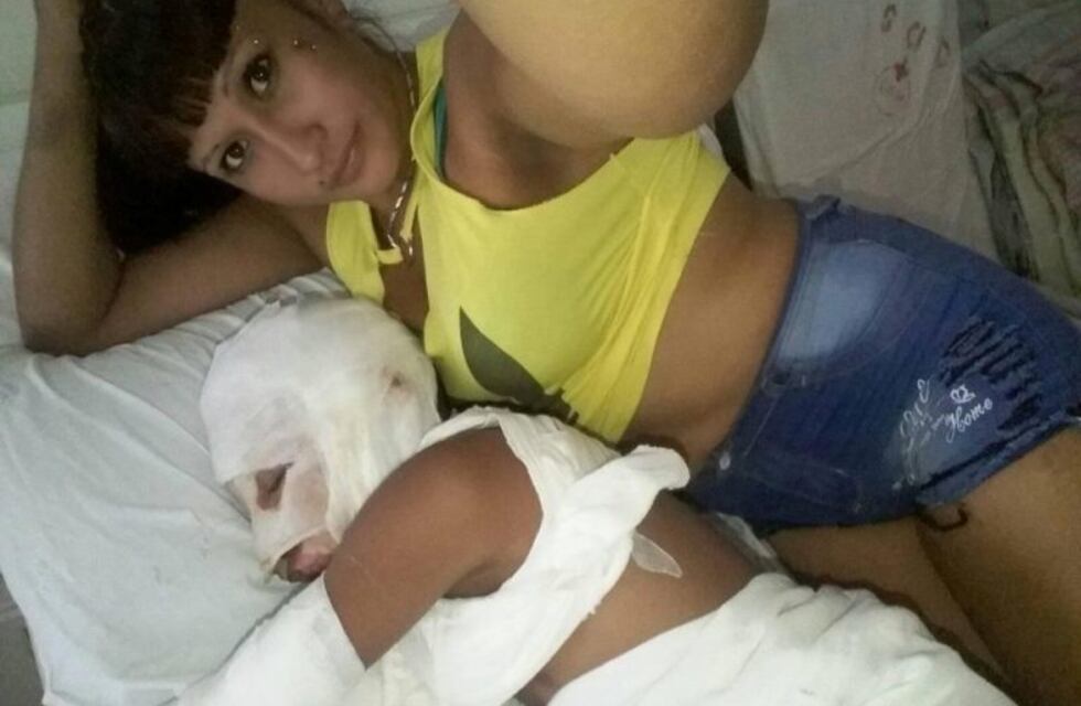 Subió una foto sensual junto a su hijo quemado y recibió durísimas críticas