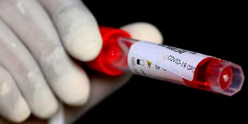 Karachi (Pakistan), 17/07/2020\u002E- Pakistani health worker collects samples for Coronavirus testing of local residents in Karachi, Pakistan, 17 July 2020\u002E Countries around the world are taking increased measures to stem the widespread of the SARS-CoV-2 coronavirus which causes the COVID-19 disease\u002E EFE/EPA/SHAHZAIB AKBER
