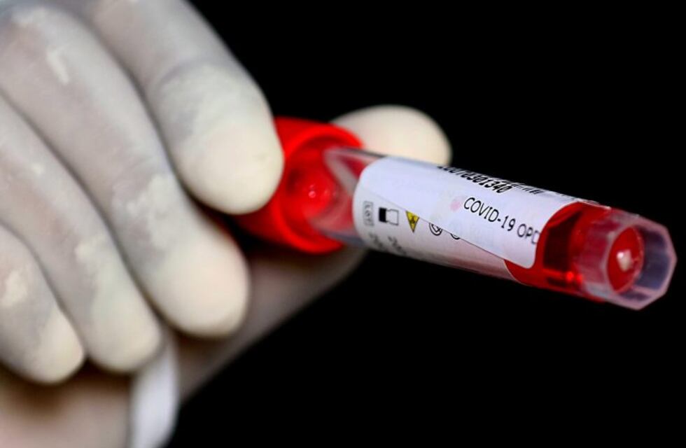 Coronavirus en Neuquén: tres fallecimientos y 136 nuevos casos en las últimas 24 horas