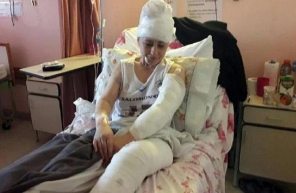 Una jauría de perros salvajes sueltos mantiene en vilo a los pobladores de Ushuaia tras el ataque a una mujer