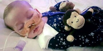 This is an undated hand out photo of Charlie Gard provided by his family, at Great Ormond Street Hospital, in London\u002E The parents of a terminally-ill baby boy lost the final stage of their legal battle on Tuesday, June27, 2017 to take him out of a British hospital to receive treatment in the U\u002ES\u002E, after a European court agreed with previous rulings that the baby should be taken off life support\u002E (Family of Charlie Gard via AP) inglaterra londres Charlie Gard Aunque sus padres se oponen, desconectan a un bebe de la maquina que lo mantiene vivo justicia autoriza que lo desconecten