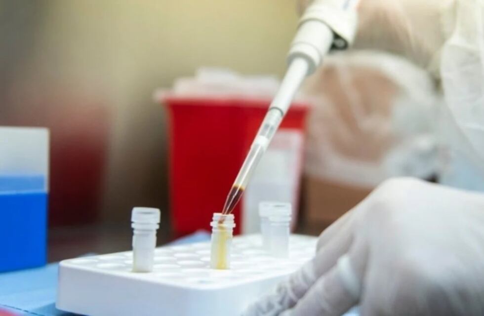 Científicos del INTA Bariloche trabajan en una vacuna contra el coronavirus