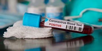 Los contactos estrechos se realizaron un PCR (web).