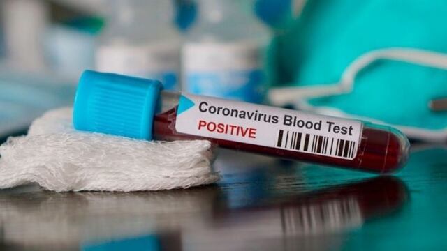 Los contactos estrechos se realizaron un PCR (web).