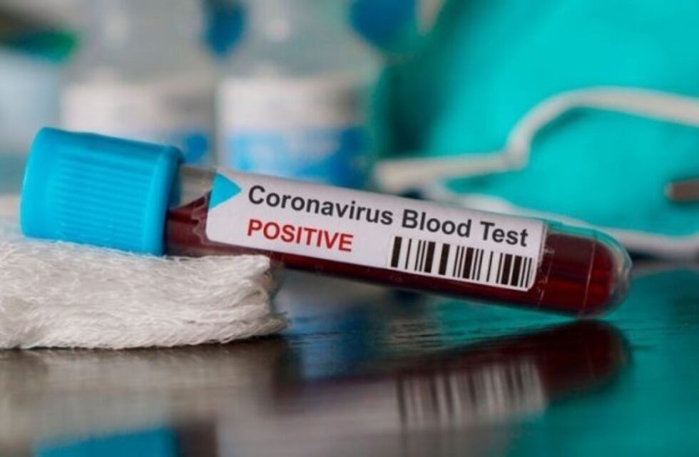 Mendoza sumó dos nuevos casos positivos de coronavirus