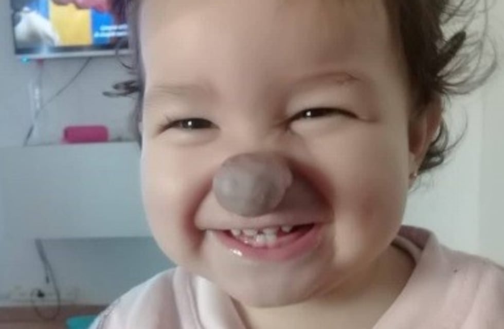 Leah "de la gente" sufre rara enfermedad y necesita ayuda