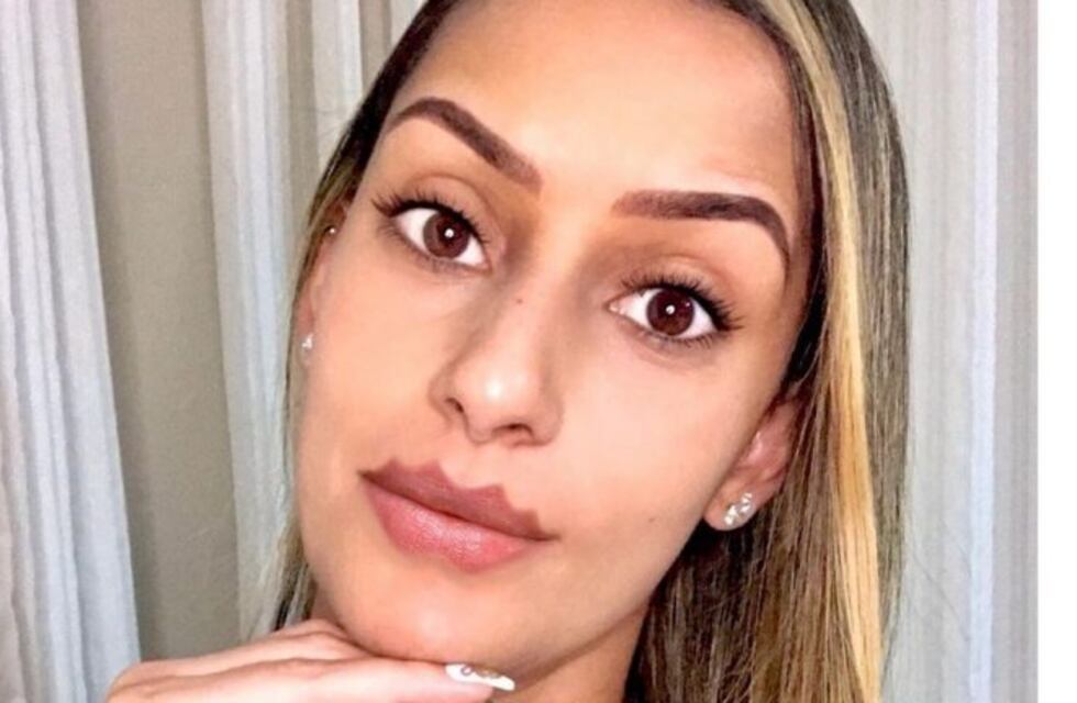 "Labios del diablo": la peligrosa tendencia beauty que se volvió viral en internet