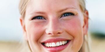 Qué es la rosácea y cómo prevenirla\u002E