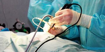 Cirugía endoscópica (Web)