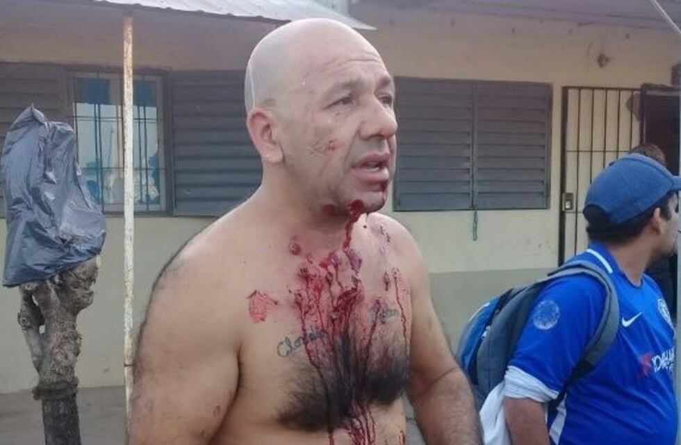 Denuncian salvaje agresión policial contra un hombre en un procedimiento