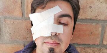 Hombre agredido\u002E