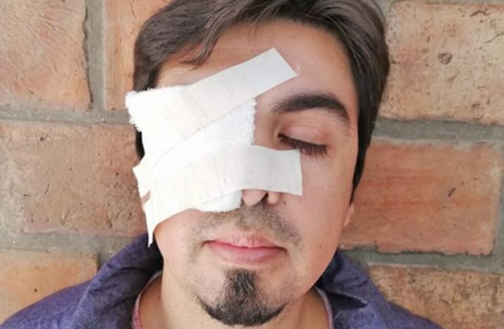 Un automovilista denunció al Diputado Nacional Rodrigo Posse por agresiones