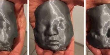 Ecografía 3D en Oulton