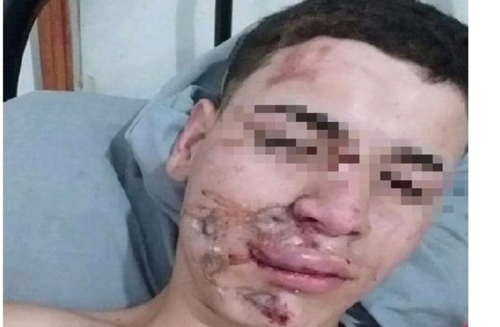Brutal agresión a joven para robarle la moto