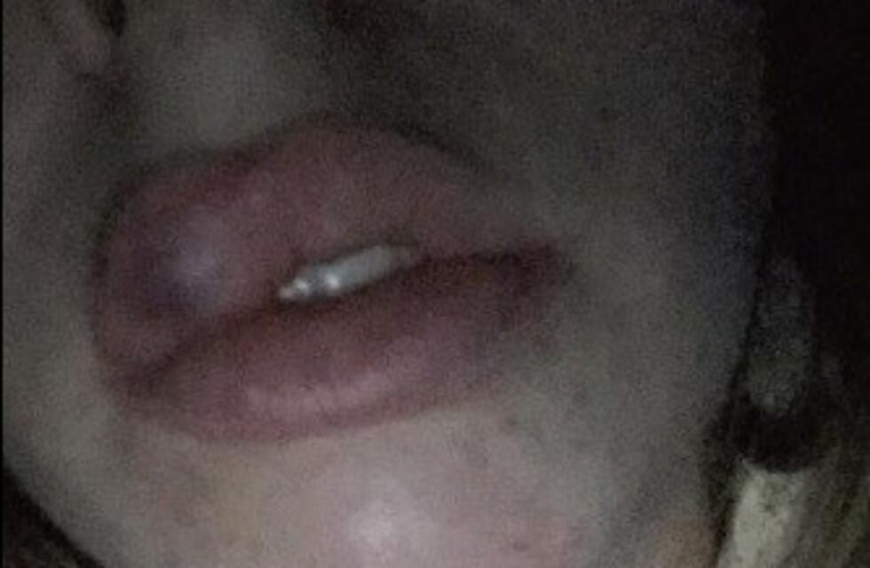 Brutal agresión a una joven deportista en un local de comida rápida