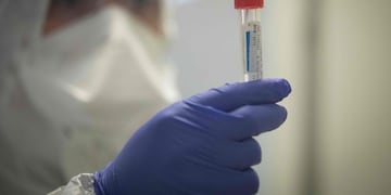 Coronavirus: el Gobierno decidió reducir impuestos a los servicios de salud\u002E (AFP)