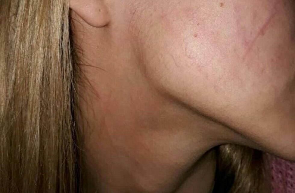 Joven denunció que sufrió un intento de secuestro cuando caminaba por el macrocentro