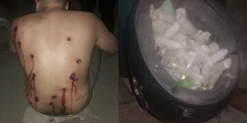 Tiros, policías y usurpadores heridos en un asentamiento\u002E (La Gaceta)