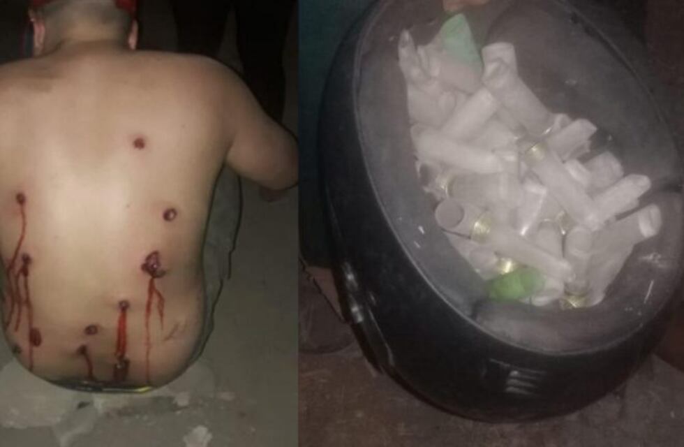 Tiros, policías y usurpadores heridos en un asentamiento