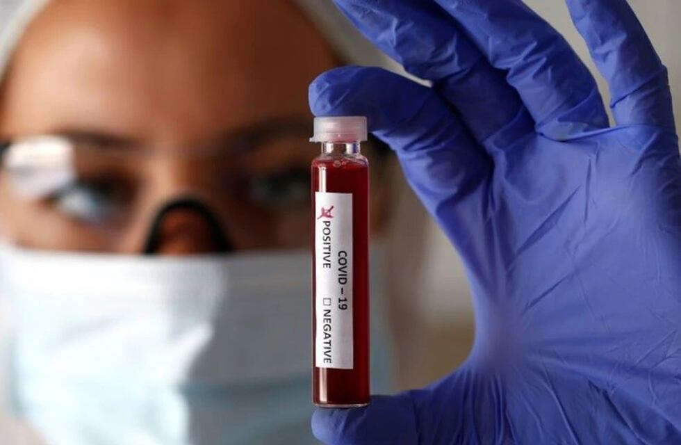 Noveno caso de coronavirus confirmado en Villa Carlos Paz