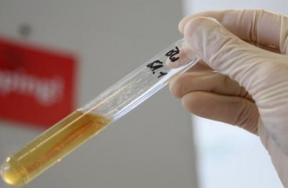 Ley Antidóping: proponen mejoras para que su aplicación en el municipio sea más eficaz