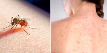 La dispersión en el número de casos de la epidemia determina un subregistro