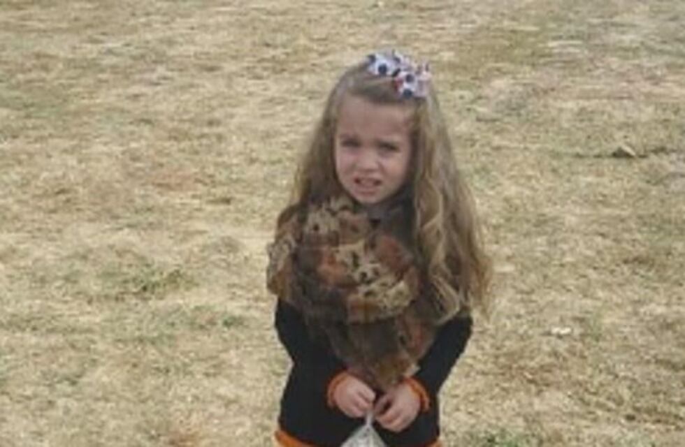 La insólita ilusión óptica de la "nena desnutrida" que se hizo viral