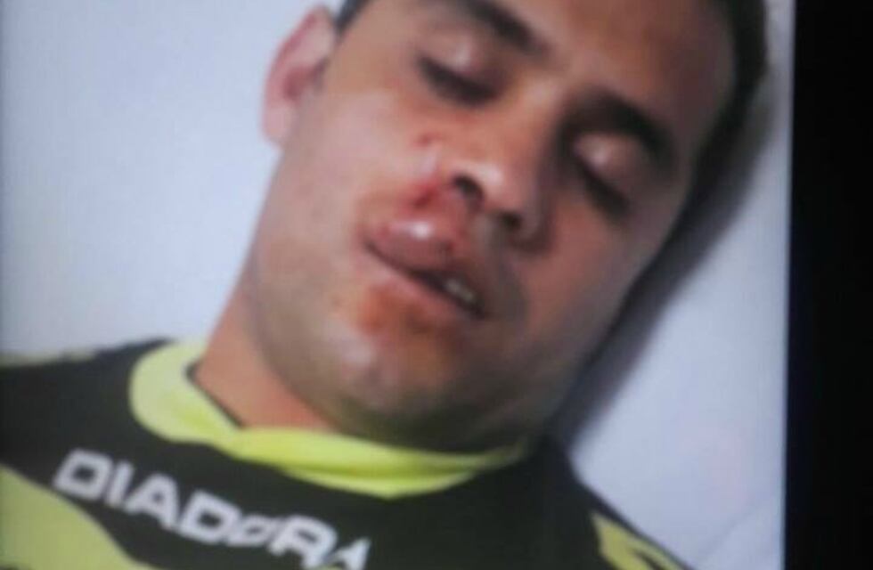 Sacadísimo: un arquero noqueó al juez de línea y el partido se suspendió a los 3 minutos