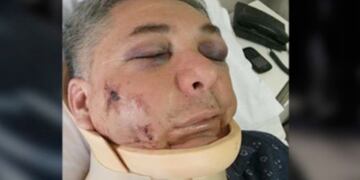 El comisario Ariel Ureta, internado en la Clínica Francesa\u002E