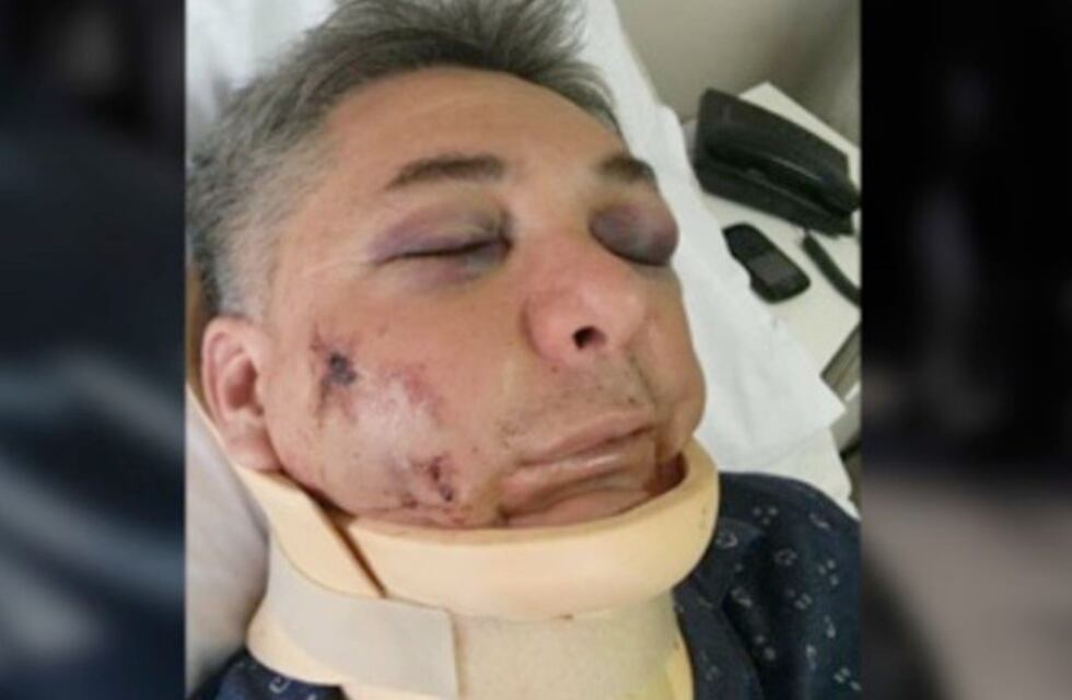 Un comisario fue atacado en el oeste de Godoy Cruz y le desfiguraron la cara