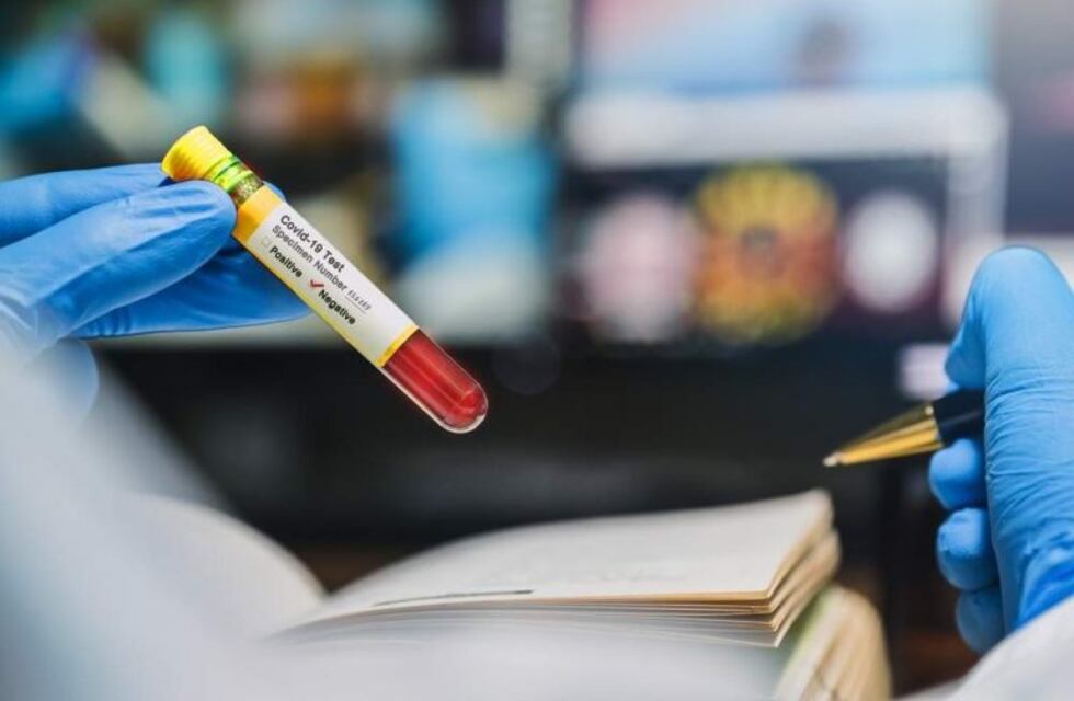 El coronavirus azota a Chaco: ocho muertos y 47 nuevos casos
