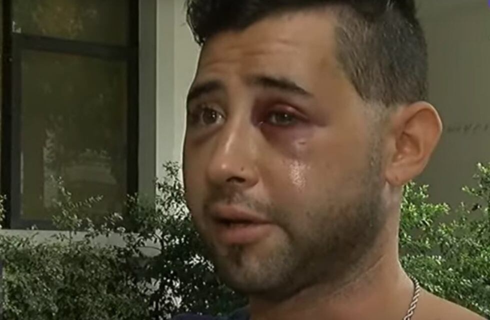 Le quebraron la mandíbula para robarle cuando salía del boliche y un taxista lo engañó