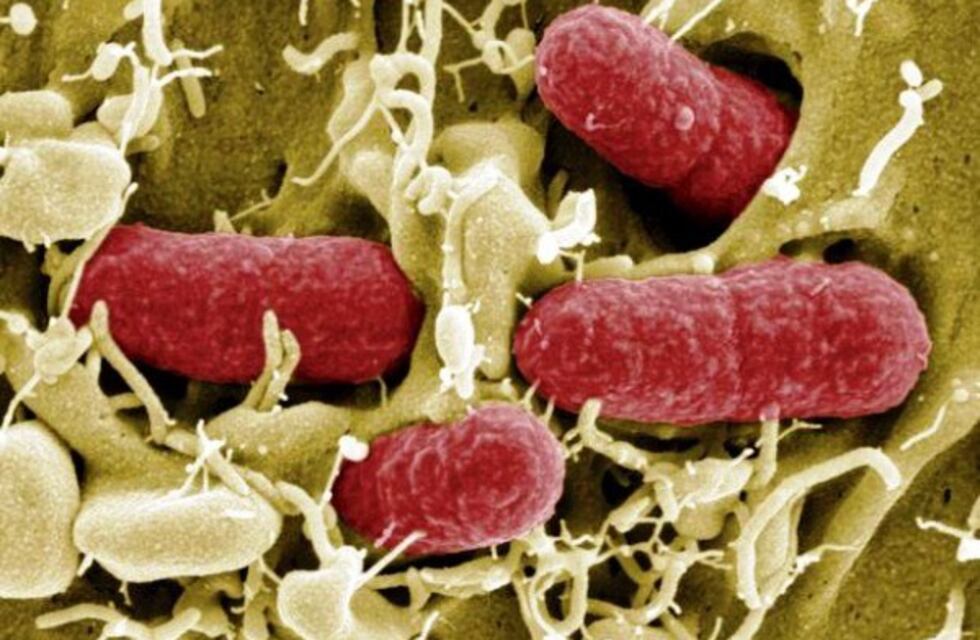 Casos de síndrome Urémico hemolítico en Río Grande