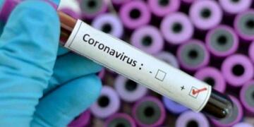 Se confirmó que Corrientes tiene un caso positivo de Coronavirus\u002E