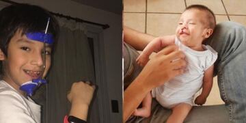 Octavio, el niño mendocino que nació con fisura labiopalatina hace 8 años\u002E