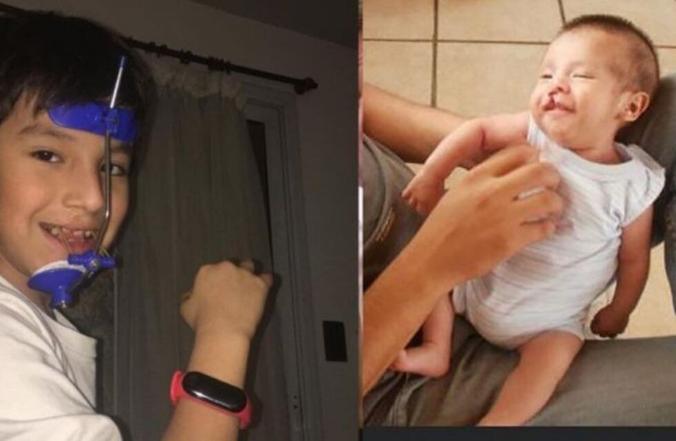 Nació con una malformación y su vida es un ejemplo de alegría y valentía