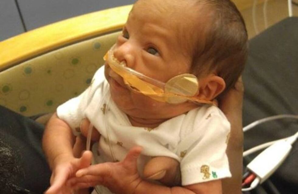 ¡Un milagro! Bebé prematuro nació envuelto en el saco amniótico