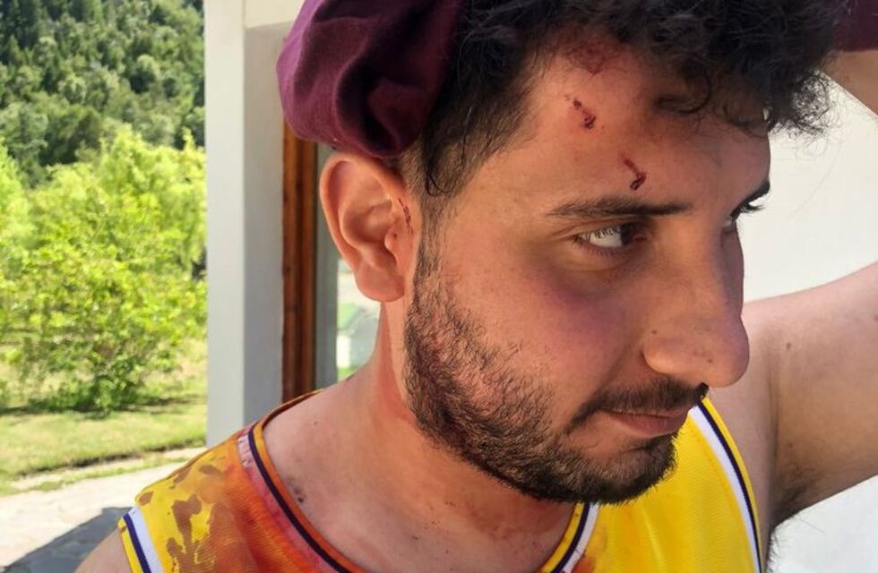 Encapuchados agredieron a dos turistas en Bariloche: “Nos quisieron matar”