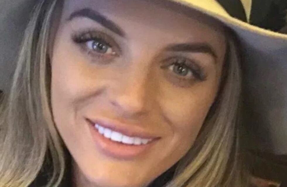 Fue a una "fiesta cosmética" y terminó con el labio horrorosamente hinchado