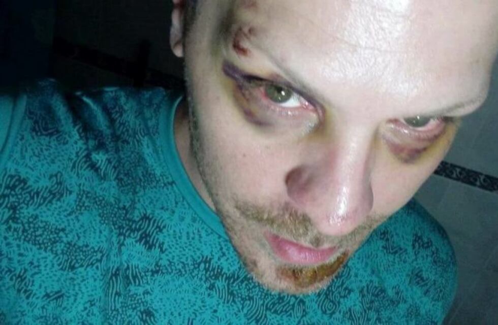 Un artista local denunció que no podrá trabajar durante seis meses por una brutal golpiza