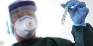 En la Provincia son 302 los infectados con Coronavirus