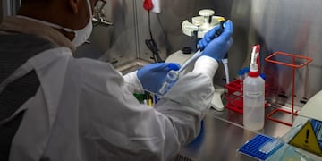 In this photograph taken Thursday May 21, 2020, a lab technician processes the samples taken from members of the Ndlovu Youth Choir for Covid-19 testing at a clinic in the Moutse Valley, 160 kms (100 miles) north east of Johannesburg, South Africa\u002E Finalists of the 2019 edition of the U\u002ES\u002E television show America's Got Talent, the coronavirus crisis put the choir's dreams on hold, as their tour got cancelled, and they returned to rural South Africa\u002E (AP Photo/Jerome Delay)