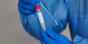 Coronavirus\u002E Test\u002E