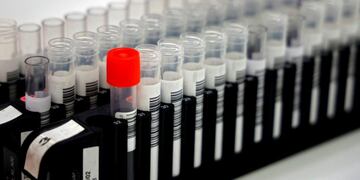 (FILES) In this file photo taken on April 22, 2020 A picture shows samples suspected of being COVID-19 positive before analysis in a laboratory that analyses thousands of samples each day, in Levallois-Perret, near Paris, on the 37th day of a lockdown in France to stop the spread of the COVID-19 pandemic, caused by the novel coronavirus\u002E - Covid-19: more than 40,000 new cases in France in 24 hours, a record, announced by offical source on October 23, 2020\u002E (Photo by THOMAS COEX / AFP)