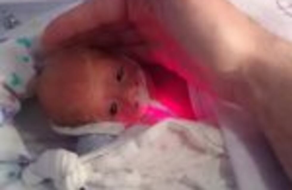 La historia del bebé que le salvaron la vida con una bolsa