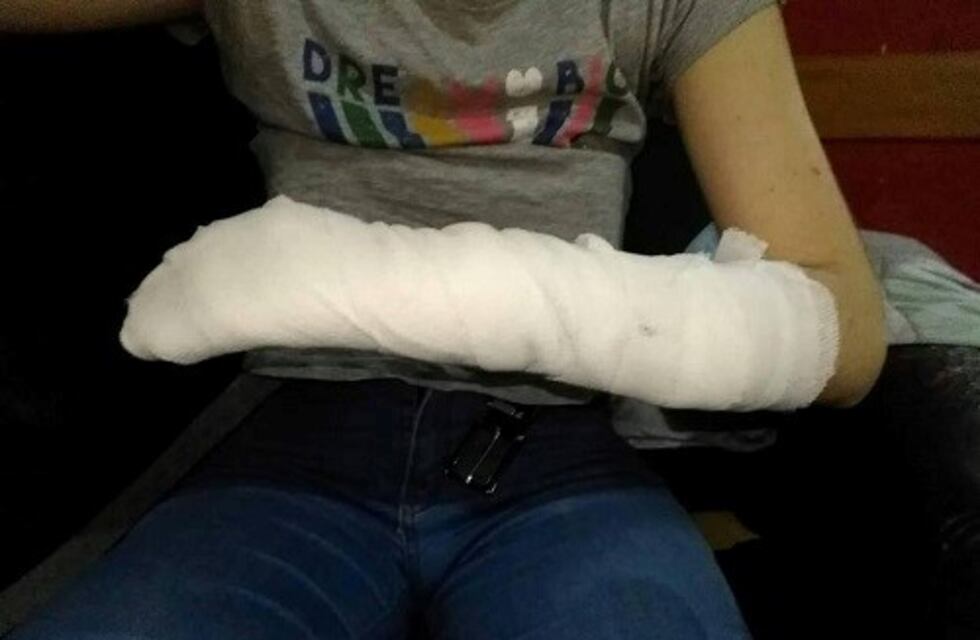 Buscan a un conductor que atropelló y dejó con serias heridas a una pareja