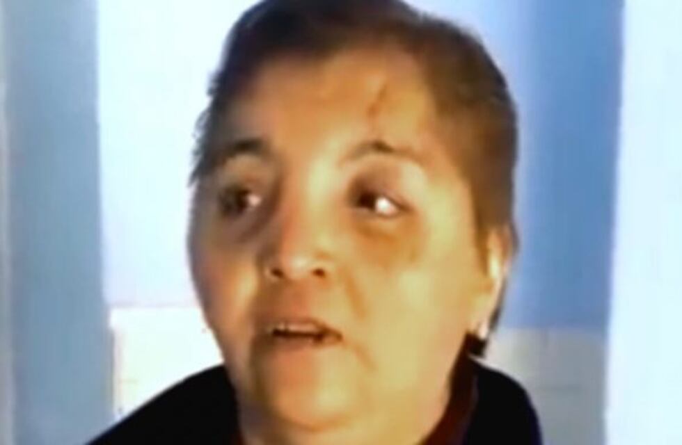 Sobrevivir a un ataque femicida: "Me pegó un mazazo por cada año de convivencia"